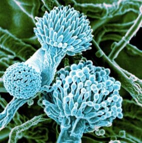 Aspergillus Mold under a microscope